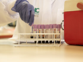 Pessoa com luva azul separando um tubo de ensaio